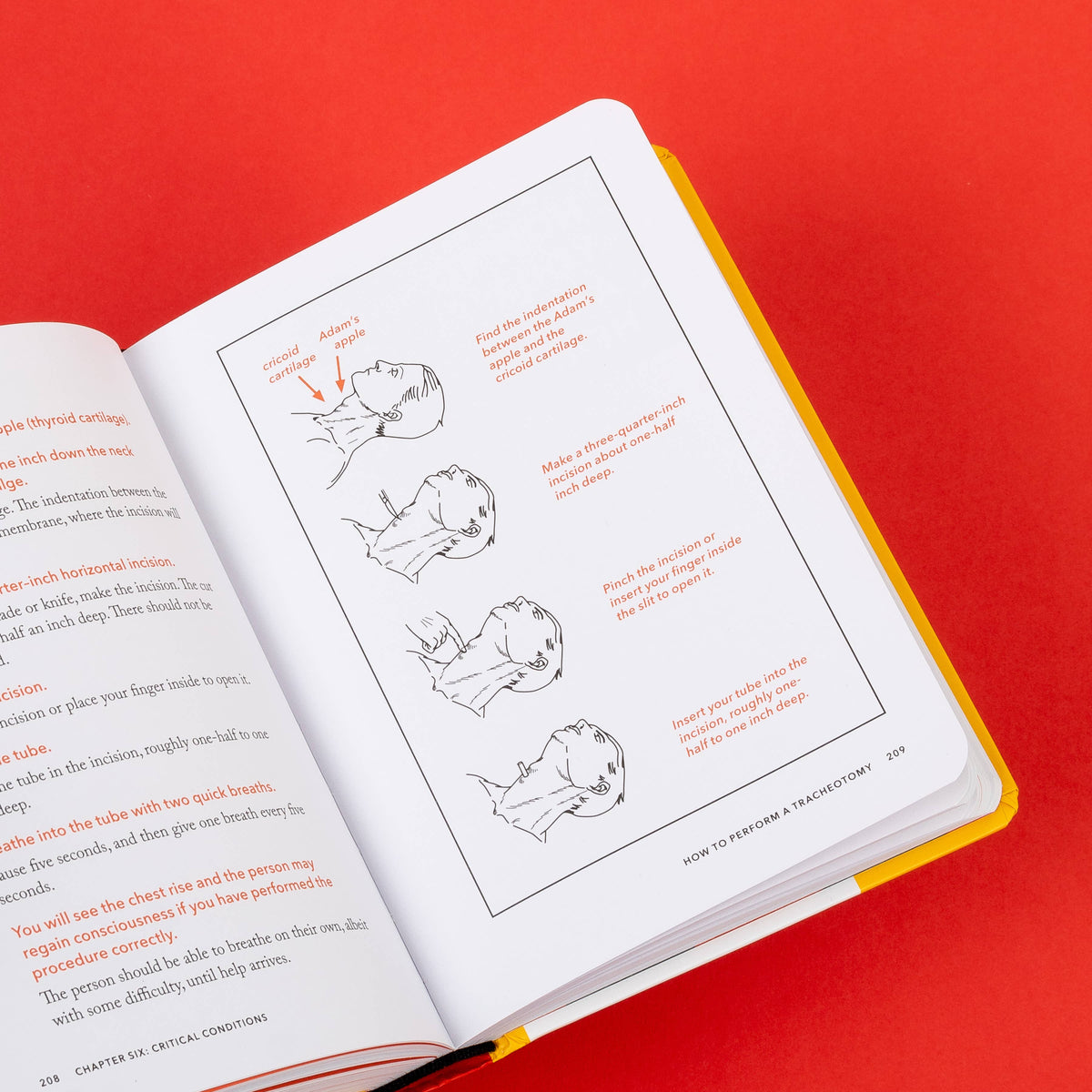 Handbook page with four step-by-step drawings showing how to perform a tracheotomy